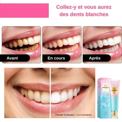 🏆Dernier jour 49% de réduction🦷 Dentifrice blanchissant à la niacinamide – Pour des dents plus saines et plus blanches !