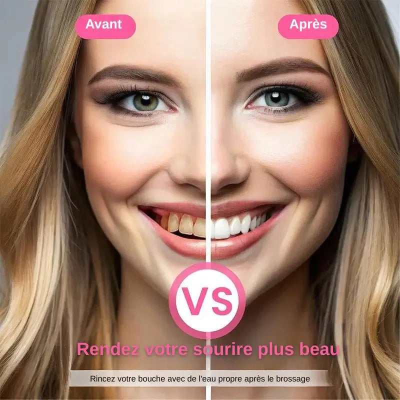 🏆Dernier jour 49% de réduction🦷 Dentifrice blanchissant à la niacinamide – Pour des dents plus saines et plus blanches !