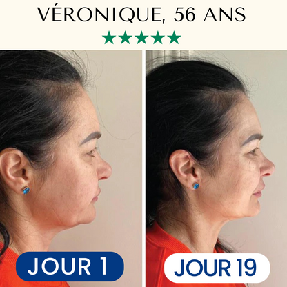 Masque Liftant Réutilisable VitaléSkin™