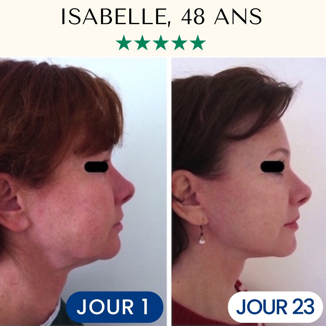 Masque Liftant Réutilisable VitaléSkin™