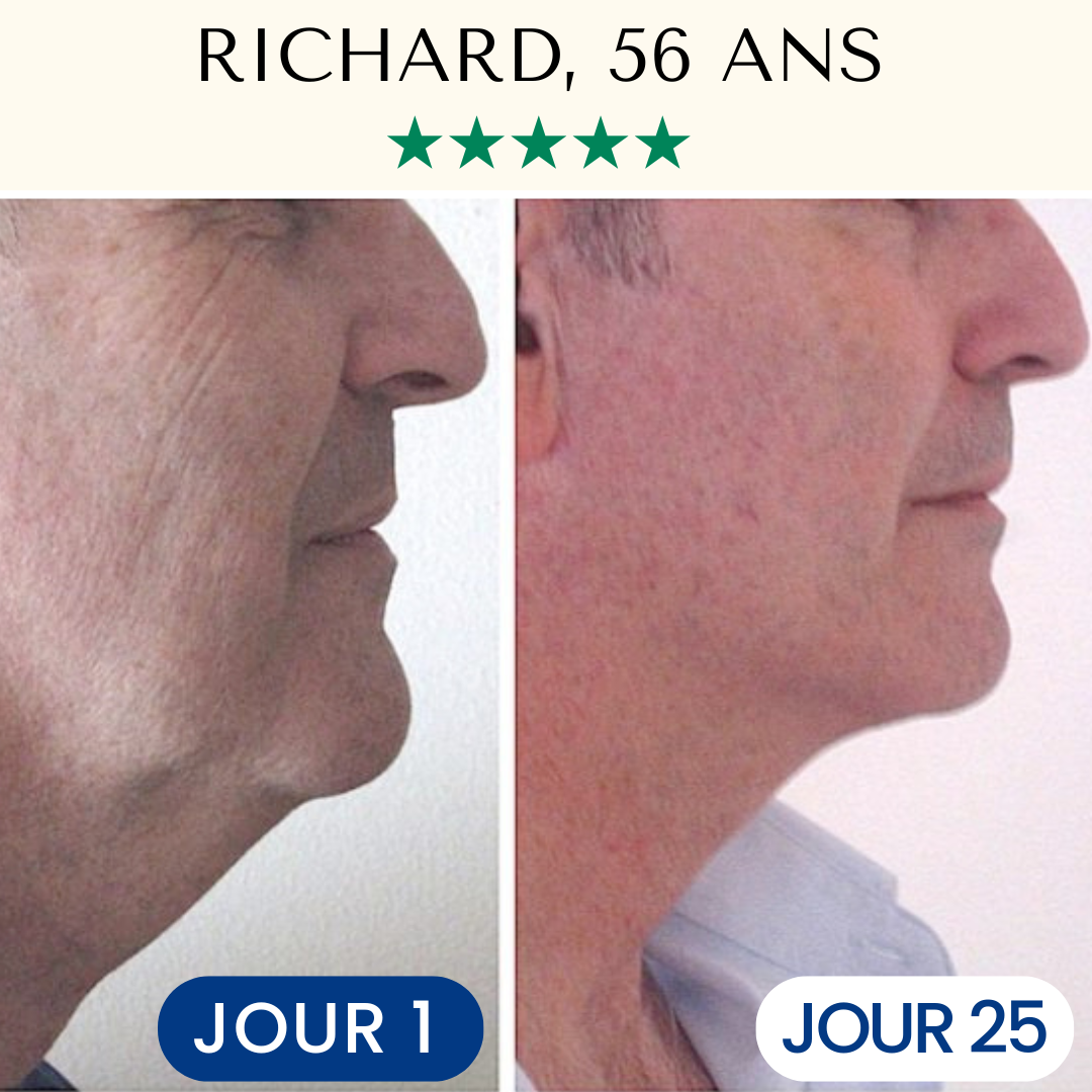 Masque Liftant Réutilisable VitaléSkin™