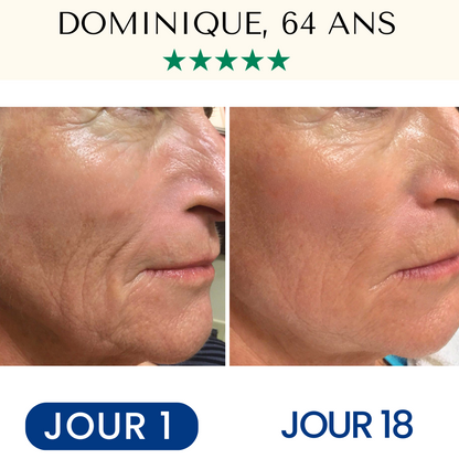 Masque Liftant Réutilisable VitaléSkin™