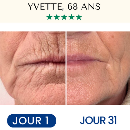 Masque Liftant Réutilisable VitaléSkin™